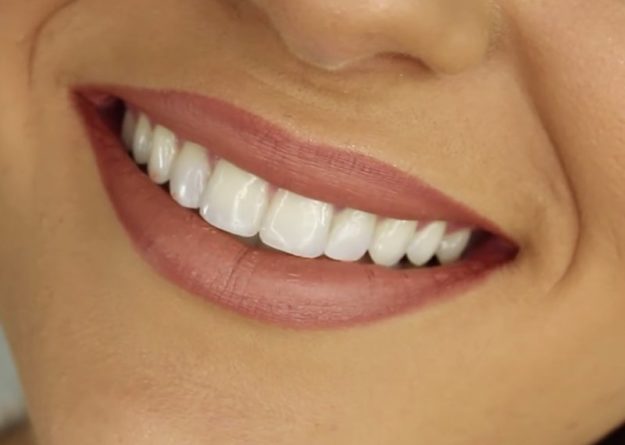 Dentist Edmonton