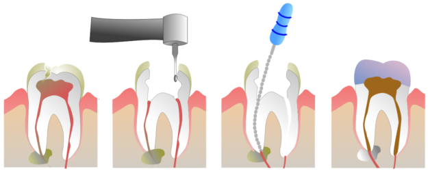 Restorative Dentistry Edmonton