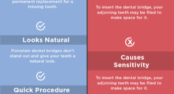 Dental Bridges: Pros And Cons