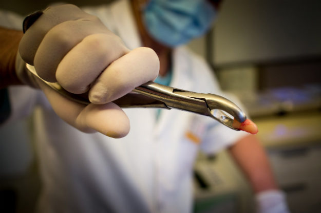 Dental Injuries Dental Injuries