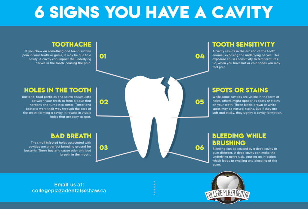 6 Signs You Have A Cavity College Plaza Dental Associates 6-signs-you-have-a-cavity-college-plaza-dental-associates