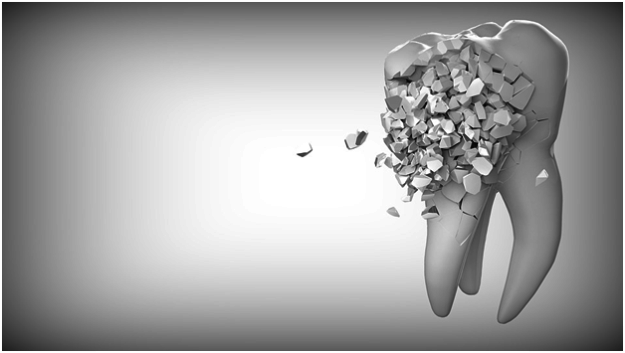 Tooth Decay Causes