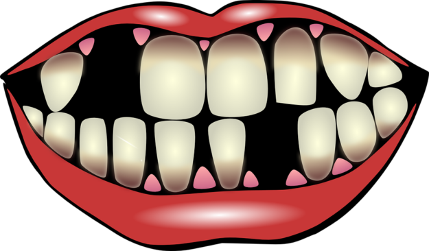 Dental Mistakes